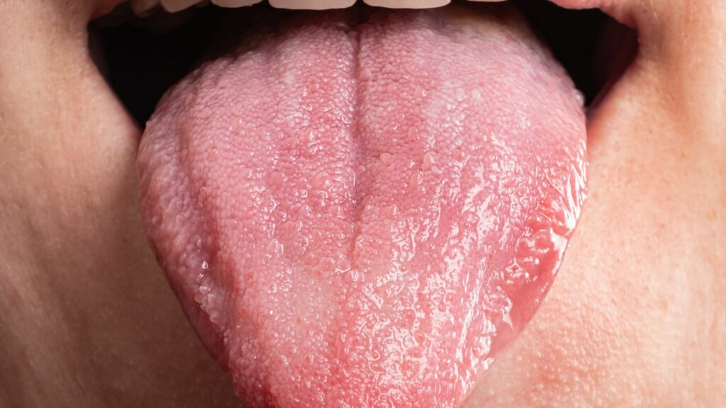 Your tongue is a topographical map